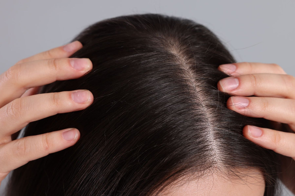 Itchy Scalp but No Dandruff? 7 Possible Causes - Number 4 Hair Care