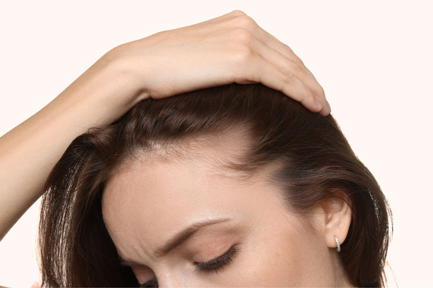 Same-Same but Different: Dandruff vs. Dry Scalp - Number 4 Hair Care